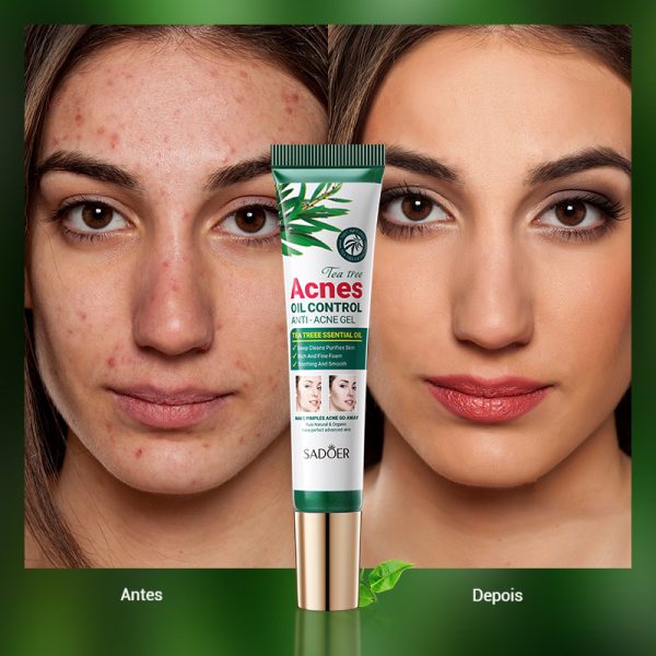 Gel Hidratante Facial com Protetor Solar - Imagem 5